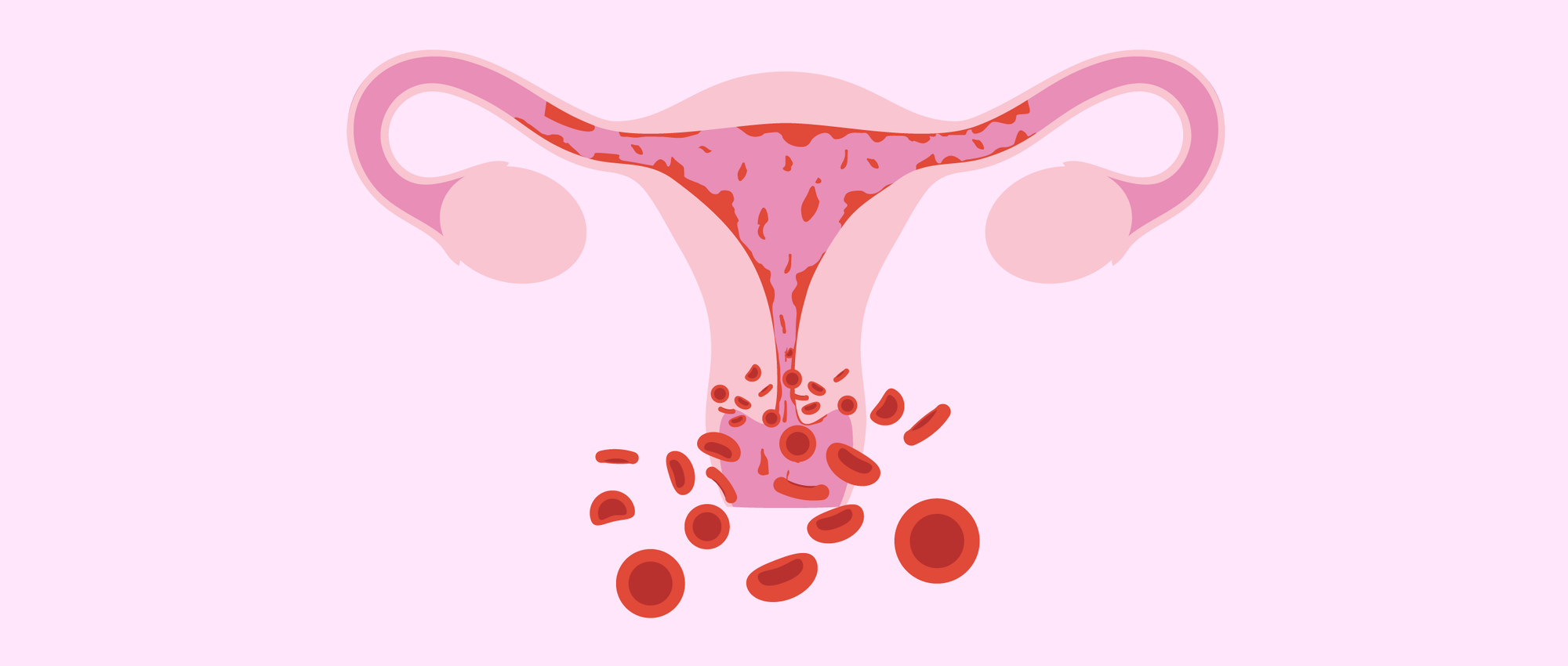 Ung thư cổ tử cung là gì?